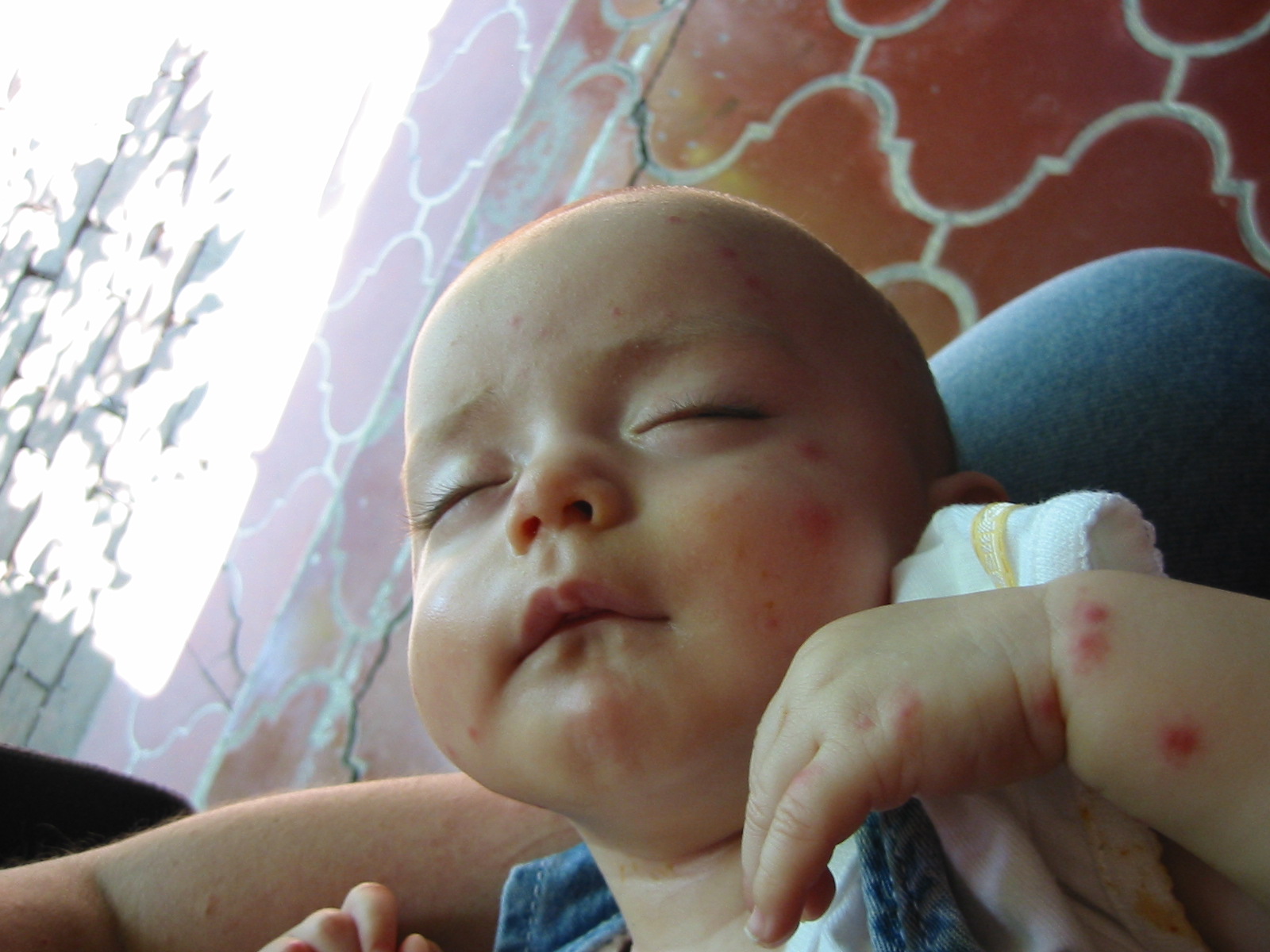 What Do Mosquito Bites Look Like On Babies When Allergic Or On Dogs What Do Mosquito Bites Look Like On Babies When Allergic Or On Dogs